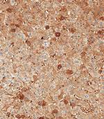 Albumin Polyclonal Antibody