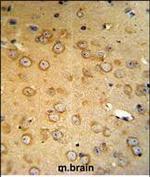 VHL Polyclonal Antibody