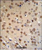 AMER1 Polyclonal Antibody