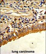 Osteopontin Polyclonal Antibody