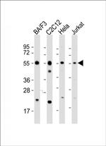 Caspase 8 Polyclonal Antibody