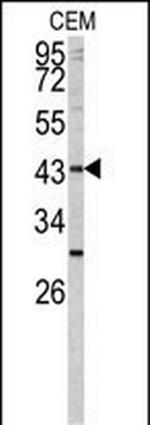 FUT1 Polyclonal Antibody