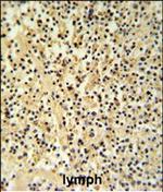 Granzyme B Antibody in Immunohistochemistry (Paraffin) (IHC (P))