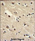EEF1A1 Antibody in Immunohistochemistry (Paraffin) (IHC (P))