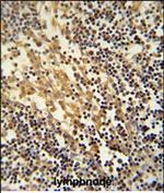 TNFAIP2 Polyclonal Antibody