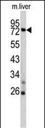 TNFAIP2 Antibody in Western Blot (WB)