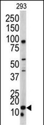 BAALC Antibody in Western Blot (WB)