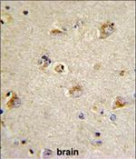 CDCA3 Polyclonal Antibody