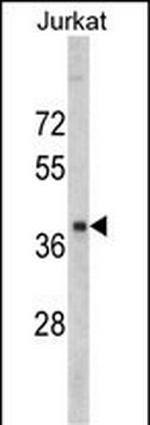RRM2 Antibody in Western Blot (WB)