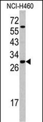 SRSF5 Polyclonal Antibody
