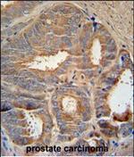 AZGP1 Polyclonal Antibody