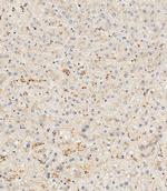 Hemopexin Polyclonal Antibody