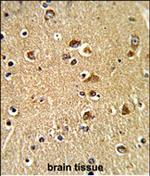 PDIA6 Polyclonal Antibody