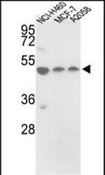 PDIA6 Antibody in Western Blot (WB)