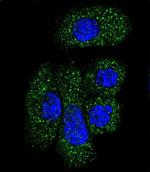 C1 inhibitor Polyclonal Antibody