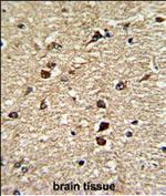 CRM1 Polyclonal Antibody