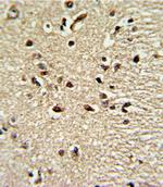 PAX4 Polyclonal Antibody