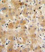 Transthyretin Polyclonal Antibody