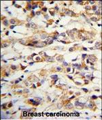 Cytokeratin 14 Polyclonal Antibody