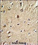 Biglycan Polyclonal Antibody