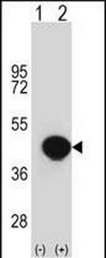 Biglycan Antibody in Western Blot (WB)