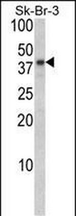 Biglycan Antibody in Western Blot (WB)