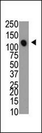 MTMR4 Antibody in Western Blot (WB)
