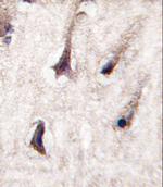 PKC beta-2 Polyclonal Antibody
