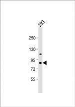 PKC epsilon Polyclonal Antibody