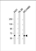 PKC eta Polyclonal Antibody