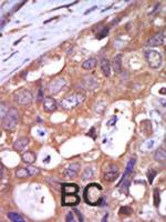 PKC mu Antibody in Immunohistochemistry (Paraffin) (IHC (P))
