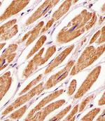 PDK4 Antibody in Immunohistochemistry (Paraffin) (IHC (P))