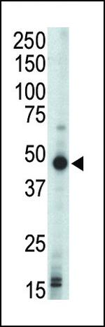 PRKAR1B Antibody in Western Blot (WB)