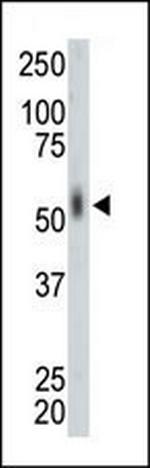 MKNK2 Antibody in Western Blot (WB)