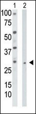 TK2 Antibody in Western Blot (WB)