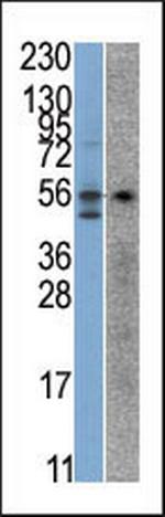 STK38 Antibody in Western Blot (WB)