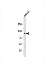 TAOK1 Antibody in Western Blot (WB)