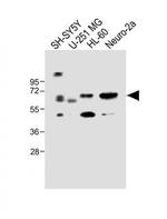 CERK Antibody in Western Blot (WB)