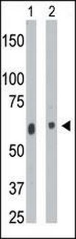 CERK Antibody in Western Blot (WB)