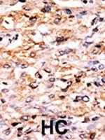 GCN2 Antibody in Immunohistochemistry (Paraffin) (IHC (P))