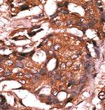 GUCY1A3 Antibody in Immunohistochemistry (Paraffin) (IHC (P))