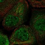 TTMP Polyclonal Antibody