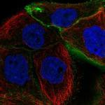 Podoplanin Polyclonal Antibody