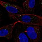 MGRN1 Polyclonal Antibody