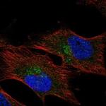 HMCN1 Polyclonal Antibody