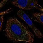 TMEM9 Polyclonal Antibody