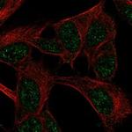 FANCF Polyclonal Antibody