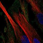 CD109 Polyclonal Antibody