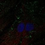 SHROOM4 Polyclonal Antibody