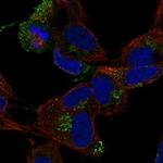 CCDC136 Polyclonal Antibody